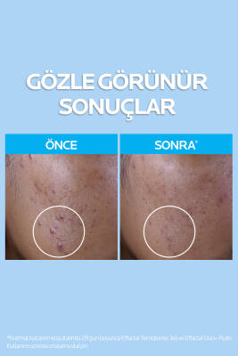 Effaclar Yağlı ve Akneye Eğilimli Citler için Temizleme Jeli 400 ml - 2