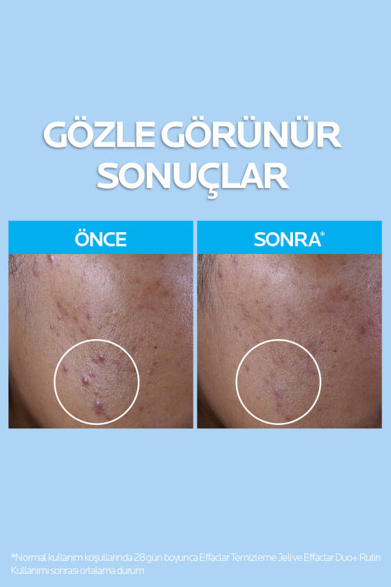Effaclar Yağlı ve Akneye Eğilimli Citler için Temizleme Jeli 400 ml - 2