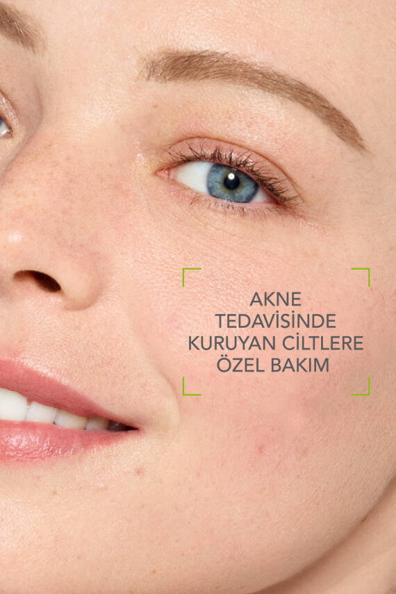 Sebium İzokit Kurutucu Akne Tedavisine Destek Cilt Bakım Kiti(Temizleme Jeli-Bakım Kremi-Dudak Balm) - 5